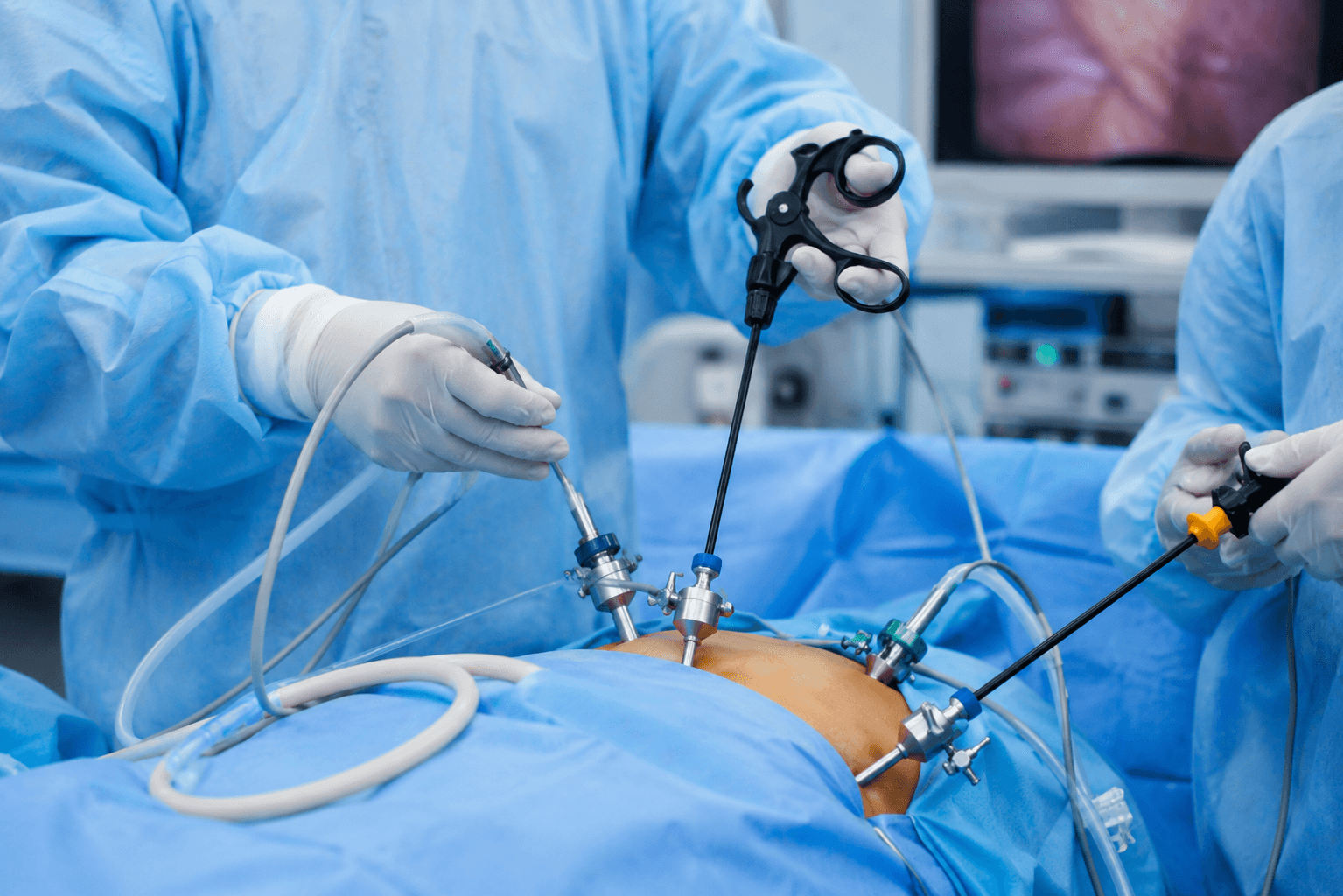 Advanced Surgery